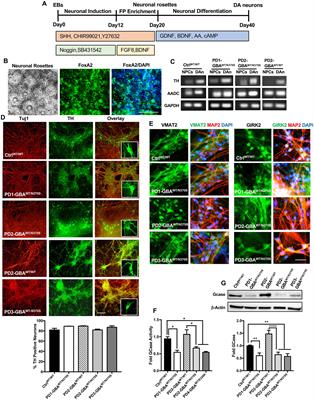 Deregulation of mTORC1-TFEB axis in human iPSC model of GBA1-associated Parkinson’s disease